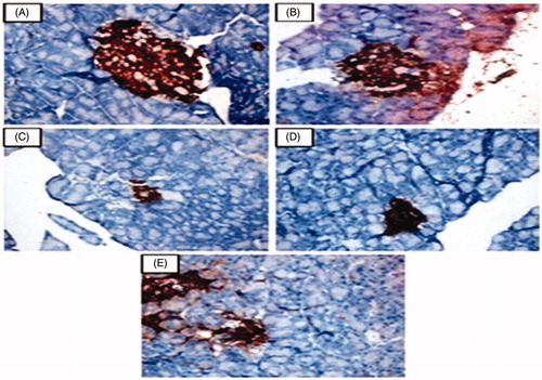 Figure 4. This figure shows the immunoexpression pattern of insulin secreting cells in pancreatic islets observed in the normal control and experimental rats in each group (40×). (A and B) Normal control and normal control + geraniol (200 mg/kg b.w.) treated rats showed normal immunohistochemical expression of insulin secreting cells in pancreatic islets. (C) Diabetic control showed decreased staining of insulin secreting cells in pancreatic islets. (D and E) Diabetic + geraniol (200 mg/kg b.w.) and diabetic + glyclazide (5 mg/kg b.w.) treated rats showed increased insulin secreting cells in pancreatic islets.