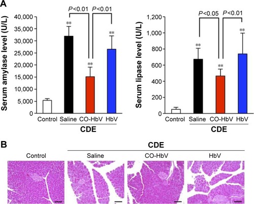 Figure 2 Evaluation of therapeutic effects after the administration of saline, HbV, and CO-HbV to CDE diet-induced acute pancreatitis mice.Notes: (A) Serum amylase and lipase levels at 3 days after the start of the CDE diet. Each value represents the mean ± standard deviation (n=6). **P<0.01 versus control. (B) Representative HE-stained pancreatic sections. Scale bars represent 100 μm.Abbreviations: CDE, choline-deficient ethionine-supplemented; CO-HbV, carbon monoxide-bound hemoglobin vesicle; HE, hematoxylin and eosin.