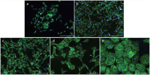 Figure 5. The morphological changes of bGCs during in vitro expansion. (a-e): bGCs from the primary culture, 7th passage, 14th passage, 22nd passage, and 25th passage. Actin filament was stained with Phalloidin CruzFluor™ 488 Conjugate (green) and nuclear was stained with DAPI (blue). Scale bar = 223.64 µm.