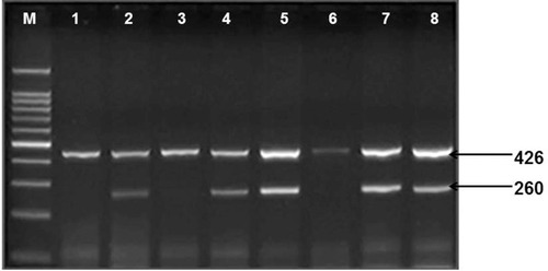 Figure 2 Shows IFN-γ (874-A/T) gene amplification. Lane M: 100 bp DNA marker, Lanes 2.4 and 8: amplification of allele T, Lanes 5 and 7: amplification of allele A. Lanes 1.2 and 3.4: Homozygous mutant, Lanes 5 and 6: wild type genotypes, Lanes 7 and 8: heterozygous genotype, 426 bp band for human growth factor gene (internal control).