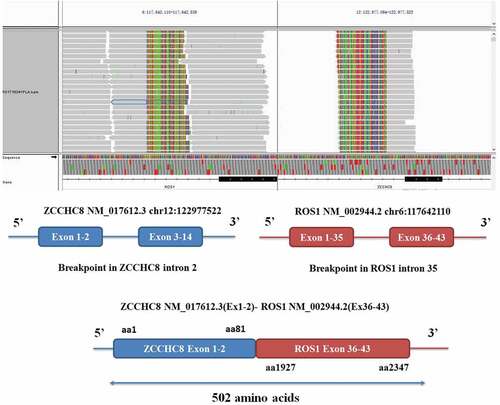 Figure 1. ZCCHC8-ROS1 fusion is clinically actionable. A, the integrative genomics viewer snapshot of ZCCHC8-ROS1. soft-clipped bases can match each other in reverse complementarity. B, schematic representation of the ZCCHC8-ROS1 fusion protein domain structure. Blue, ZCCHC8; red, ROS1; ZCCHC8-ROS1. Fusion protein is 502 amino acids in length.