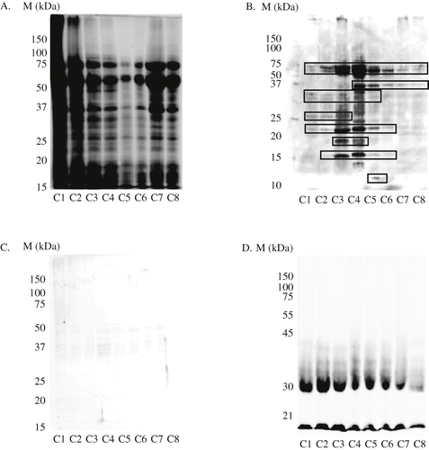 Figure 2 Reaction of allergy-specific human IgE to wheat on protein fraction. A, SDS-PAGE of 6 crude samples. B, Salt-soluble albumin/globulin. C, Salt-insoluble protein (glutenin). D, Alcohol-7 soluble protein (gliadin). M, protein marker; C1-C8, polished-graded wheat flours.