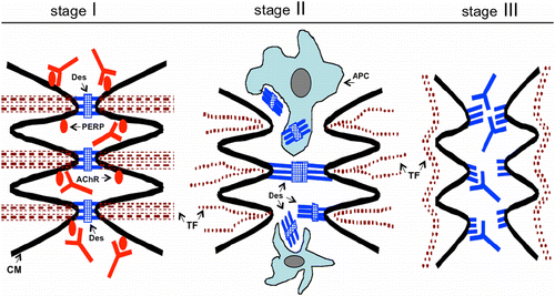 Figure 4.  Hypothetical scheme of the time course of pathobiologic events leading to acantholysis in pemphigus. In stage I, antibodies to PERP and/or cellular AChR block the physiologic control of polygonal cell shape and intercellular adhesion. This increases phosphorylation of adhesion molecules with their subsequent dissociation from the adhesion units on CM, and also initiates programed cell death. In stage II, the tonofilament (TF). cytoskeleton collapses and keratinocytes shrink with associated sloughing of desmosomes which elicits autoimmune response to the desmosomal antigens. In stage III, anti-Dsg antibodies bind to their targets on the CM of keratinocytes thus precluding formation of new intercellular junctions. Modified from Ref. Citation[55].