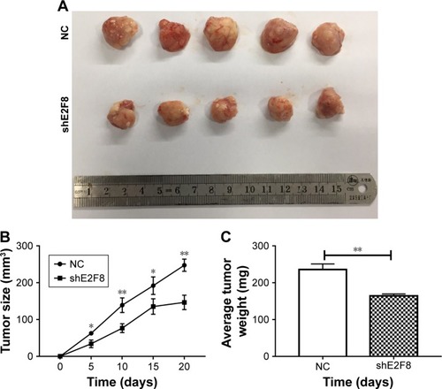 Figure 4 Downregulated E2F8 inhibits tumorigenicity in vivo.