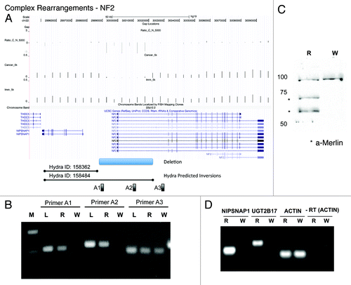 Figure 5. Complex rearrangements delete the NF2 gene. (A) UCSC genome browser snapshot of the NF2/NIPSNAP1 locus depicting the read depths for Cancer (WPE1-NB26) and Immortalized (RWPE1) and Ratio_C_N_5000 that shows the small deletion in the promoter region of NF2. The AbCNV deletion is shown at the bottom followed by the two HYDRA predicted inversion breakpoints. A1, A2 and A3 are the primer pairs used in (B). (B) PCR validation of the NF2 copy number deletion in genomic DNA. M:MW marker, L:normal lung, R:RWPE1, W:WPE1-NB26. PCR primer pairs shown at the top and (A). (C) Western blot for Merlin (NF2) in R (RWPE1) and W (WPE1-NB26). The * show the two different isoforms of Merlin. The uppermost band is a cross-reactive band that serves as loading control. (D) RT-PCR to show loss of expression of NIPSNAP1 and UGT2B17 mRNA in WPE1-NB26 (W) compared with RWPE1 (R). Actin shows that equal amounts of mRNA were input from the two cell lines. -RT: Actin PCR without the reverse-transcription step.