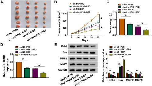 Figure 3 Role of circHIPK2 knockdown in DDP resistance and tumorigenicity of DDP-resistant OvCa cells in vitro. A2780/DDP cells stably transfected with sh-NC or sh-circHIPK2 were inoculated in nude mice, followed with DDP or PBS treatment. (A) Xenograft tumors in each group (n=6) were presented. (B) Tumor volume was monitored every 7 days. (C) Tumor weight was examined after cell inoculation for 35 days. (D) RT-qPCR detected circHIPK2 expression and (E) Western blotting detected protein expression of Bcl-2, Bax, MMP2, and MMP9 in xenograft tumor tissues. *P<0.05. Data analysis was performed using one-way or two-way ANOVA followed with Tukey’s post-hoc analysis.