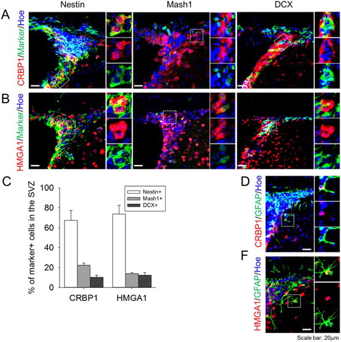 Figure 3. Expression profile of CBRP1 and HMGA1 in the SVZ. (A,B) CRBP1 and HMGA1 proteins were stained with Nestin (marker for type B cell), Mash1 (marker for type C cell), and DCX (marker for type A cell). (C) Quantification of the percentage of type B, C, and A cells with CRBP1 or HMGA1 in the SVZ. Statistical signiﬁcance of differences between the groups was evaluated by independent sample t tests. All the analyses were carried out with SPSS software, and all values are given as mean ± SEM. A p-value <0.05 was considered statistically signiﬁcant. (D,E) Representative images of CRBP1 + GFAP+ and HMGA1 + GFAP+ cells. Hoechest33343 was used as a nuclear marker. Inset images were shown from magnified cells.