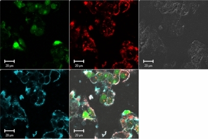 Figure 2 Confocal imaging of polyplexes uptake. Confocal microscopy images of HepG2 live cells 24 hours post transfection with chitosan/DPP-IVODN polyplexes (N/P = 5). Chitosan 92–10 (DDA, MW) was labeled with Rhodamine (red), the DPP-IVODN with 6FAM at the 5′extremity (green), and the cell membranes were stained prior to imaging with cell mask (blue). Membrane staining was performed to differentiate between internalized and membrane bound polyplexes.