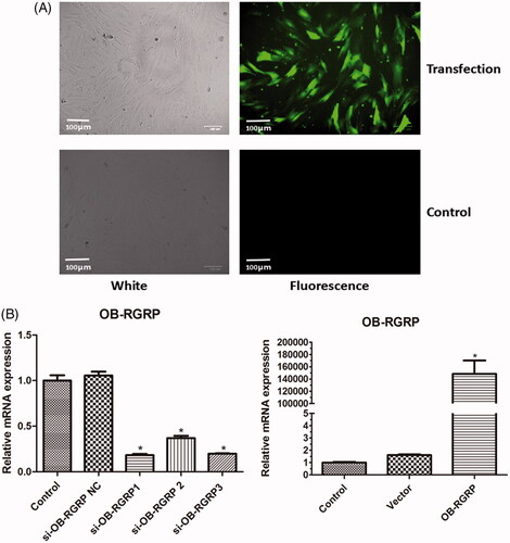 Figure 2. Fluorescence images of cells after OB-RGRP was transfected (A) and mRNA levels of OB-RGRP in the cells transfected with different siRNAs of OB-RGRP and overexpression vector of OB-RGRP which were determined by RT-PCR (B). si-OB-RGRP1: OB-RGRP-siRNA-1; si-OB-RGRP2: OB-RGRP-siRNA-2; si-OB-RGRP3: OB-RGRP-siRNA-3; si-OB-RGRP NC: OB-RGRP-siRNA negative control; Vector: empty expression vector; OB-RGRP: OB-RGRP expression vector. *p < .05 vs. Control.