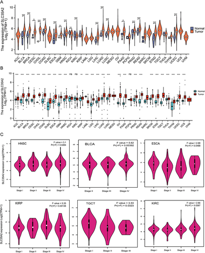 Figure 1 Differential expression analysis of SLC35A2 in pan-cancer. (A) The expression level of SLC35A2 in the TCGA tumor and adjacent normal tissues was visualized by Xiantao. (B) SLC35A2 expression levels in tumor and adjacent normal tissues from TCGA and GTEx databases, and normal tissues from GTEx database were included as controls. (C) Evaluate the correlation between the expression of SLC35A2 and the pathological stages of HNSC, BLCA, ESCA, KIRP, TGCT, and KIRC by using the GEPIA2. (*p < 0.05, **p < 0.01, ***p < 0.001).