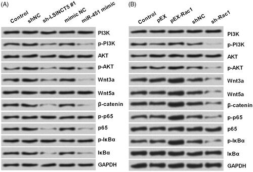 Figure 6. Activation of PI3K/AKT, Wnt/β-catenin and NF-κB pathways were affected by LSINCT5-miR-451-Rac1 axis. (A,B) After transfection with sh-LSINCT5 #1, miR-451 mimic, pEX-Rac1, sh-Rac1 or their respective controls, the protein accumulation of main components of PI3K/AKT, Wnt/β-catenin and NF-κB pathways were analyzed using Western blot.