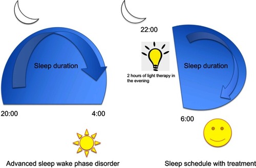 Figure 1 Management of advanced sleep–wake phase disorder.