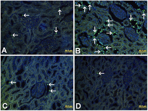 Figure 2. TUNEL staining of kidney tissue. TUNEL-positive cells (arrow) were mainly observed in distal tubule. (A) Group 1, (B) group 2, (C) group 3, and (D) group 4.