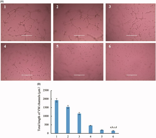 Figure 7. Destruction of VM channels in vitro formed by brain glioma U87MG cells in the three dimension (3D) matrigel after treatment with dual targeting daunorubicin plus rofecoxib liposomes. (1) Blank control; (2) daunorubicin liposomes; (3) rofecoxib liposomes; (4) daunorubicin plus rofecoxib liposomes; (5) GGPFVYLI modified daunorubicin plus rofecoxib liposomes; (6) dual targeting daunorubicin plus rofecoxib liposomes. p<.05. (a) vs. 1; (b) vs. 2; (c) vs. 3; (d) vs. 4.