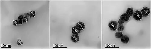 Figure 3. Transmission electron micrographs of EGCG PLGA NCs, respectively, A, B, and C for F1, F2, and F3. The measurements were displayed using Image J program (Bethesda, MD).