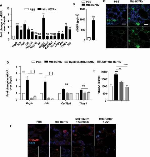 Figure 6. BRD4 modulates angiogenic genes during mycobacterial infection. (A) The transcript levels of the indicated angiogenic genes were assessed in the lung homogenates of mice infected for 44 d with Mtb H37Rv. (B) The protein level of VEGFA was analyzed in Mtb H37Rv-infected lung homogenates by ELISA. (C) The expression of PECAM1 was ascertained by immunofluorescence imaging of infected lung sections. (D) Lung homogenates of infected mice treated with gefitinib or JQ1 was analyzed for the expression of the indicated angiogenic markers by qRT-PCR. (E) The protein level of VEGFA was assessed in the lung homogenates of the indicated groups of mice by ELISA. (F) The expression of PECAM1 was assessed in the lung cryosections of Mtb H37Rv-infected and gefitinib/JQ1-treated mice. At least 3 sets of mice were utilized for each analysis derived from lung tissues obtained following therapeutic TB model and qRT-PCR data represents mean±S.E.M. from five sets of mice. Med, medium; *, p < 0.05; **, p < 0.005; ***, p < 0.001; ****, p < 0.0001 (Students t-test in A, B and one-way ANOVA in D, E; GraphPad Prism 5.0 and 8.0); ns, not significant; scale bar: 10 μm.