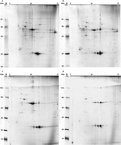 Figure 2. 2D electrophoregrams of PSMA3-bound proteins from both cytosol (a, b) and nuclear (c, d) extracts of RPMI8226 multiple myeloma cells (control ones (a, c) and after bortezomib/doxorubicin combined treatment (b, d)). Isoelectric focusing was performed in 11 cm IPG strips pH 3–11NL (GE), second dimension was carried out in Hoefer Ruby 600 electrophoresis unit (GE). Gels were stained with Coomassie G250. “M” lane: protein molecular mass marker (in kilodaltons).