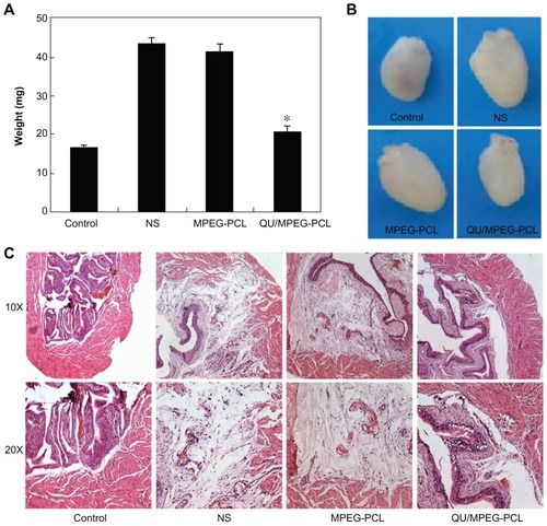 Figure 7 Therapeutic effects of intravesical application of QU/MPEG-PCL micelles on acute cystitis. (A) The weight of bladders in each treatment group. The weight of the bladder in the QU/MPEG-PCL group was less than that in the MPEG-PCL or NS group (P < 0.05). (B) Representative images of the bladders in each treatment group. The bladder in the QU/MPEG-PCL group was smaller than that in the NS group, while the bladder in the MPEG-PCL group was as large as that in the NS group. (C) Hematoxylin and eosin assay of the bladders from mice with Control, NS, MPEG-PCL, or Qu/MPEG-PCL treatment.Notes: Severe edema and lots of inflammatory cell infiltration were observed in the bladders from both the empty MPEG-PCL micelle group and the NS group, indicating that MPEG-PCL had no effect on the treatment of cystitis. However, in the QU/MPEG-PCL treatment group, no obvious edema and inflammatory cell infiltration of the bladder was detected, suggesting that QU/MPEG-PCL micelles have promising application in acute cystitis therapy.Abbreviations: MPEG, monomethoxy poly(ethylene glycol); NS, normal saline; PCL, poly(ɛ-caprolactone); QU, quercetin.