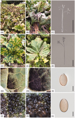 Figure 2. Downy mildew disease caused by Pseudoperonospora cubensis on oriental pickling melon (Cucumis melo var. conomon) in Korea. (A and B) Downy mildew outbreak in a field of oriental pickling melon; (D and E) Vein-limited spots above (D) and below (E) an infected leaf; (G and H) Close-up view of vein-limited downy mildew growth developing on the lower surface; (J and K) Dense sporangiophores with grayish, numerous sporangia; (C and F) Sporangiophore; (I and L) Sporangium. Scale bars: 100 μm for sporangiophore; 10 μm for sporangium.