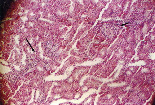 Figure 1. Rat kidney at the thinner inhalation group (granuloma formation was shown by small arrow and interstitial infiltration by large arrow).