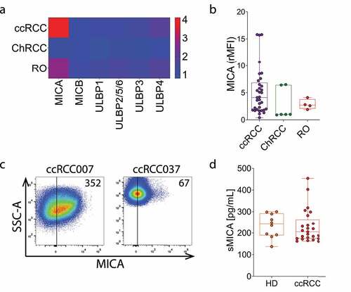 Figure 2. MICA is the most overexpressed NKG2DL on ccRCC tumor cells. A) Heatmap of expression of NKG2DLs on tumor cells from patients with ccRCC (n = 33), ChRCC (n = 6) and RO (n = 4). Blue (1) to red (4) represent increasing expression. The heatmap was built using the rMFI for each NKG2DL. B) Expression of MICA on tumor cells from patients with ccRCC (n = 33), ChRCC (n = 6) and RO (n = 4). C) Representative plots of side scatter (SSC-A) and MICA expression from two patients with high (ccRCC007) and average (ccRCC037) expression of MICA. Numbers within plots correspond to the MFI of MICA expression. Vertical lines in plots of panel C indicate the FMO. D) sMICA amounts detected in plasma of HD (n = 10) and ccRCC patients (n = 25) assessed by ELISA.
