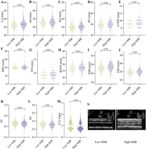 Figure 3 Comparison of cardiac ultrasound parameters between high and low NHR groups. (A) LA. (B) AO. (C) RA. (D) RV. (E) LVPW. (F) MPA. (G) IVS. (H) RVOT. (I) EDD. (J) ESD. (K) EF. (L) FS. (M) E/A Value. (N) Representative cardiac ultrasound images.