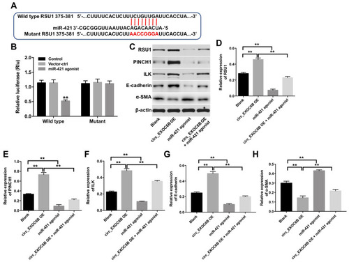 Figure 6 CircEXOC6B exhibited anti-tumor effect partially by sponging miR-421 via upregulation of RUS1. (A) The 3ʹ‐UTR of RUS1 harbors miR-421 cognate sites. (B) Relative luciferase activity of reporter plasmids carrying WT or MT RUS1 3ʹ‐UTR in SKOV3 cells following co‐transfecting with miR-421 were measured using dual-luciferase reporter assay. (C) Expression levels of RUS1, PINCH1, ILK, E-cadherin and α-SMA in SKOV3 cells were detected with Western blotting. (D–H) The relative expressions of RUS1, PINCH1, ILK, E-cadherin and α-SMA in SKOV3 cells were quantified via normalization to β-actin. **P < 0.01.