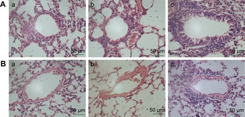 Figure 3 (A) Peribronchial and (B) perivascular inflammation in lung tissues (HE staining).Notes: (a) PBS group; (b) CSE group; (c) CSE + adenovirus group. Magnification ×200.Abbreviations: HE, hematoxylin and eosin; PBS, phosphate-buffered saline; CSE, cigarette smoke extract.