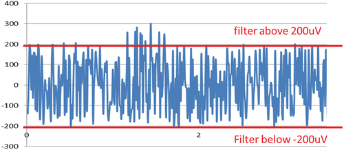 Figure 5. Adding two filters for real-time data for monitoring seizures.
