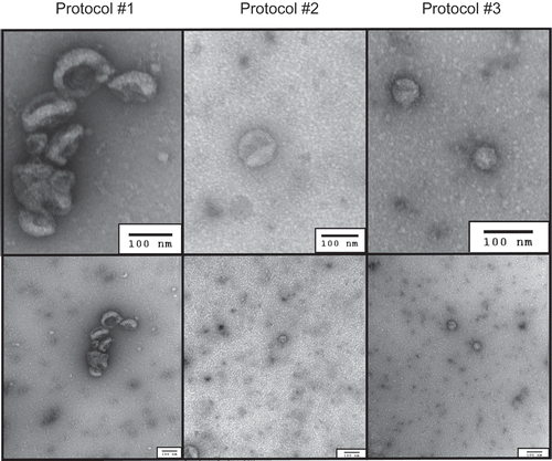 Figure 1. Representative transmission electron microscopy (TEM) images of small extracellular vesicle isolates by differential ultracentrifugation protocol, with wide-field images in the lower panels and zoom images in the upper panels. Corresponding scale bars (100 nm) are displayed in the lower right corner of each respective image.