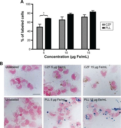 Figure 1 Labeling efficiency.Notes: (A) Number of labeled iPSC-NP cells expressed as a percentage of total cell number counted after 72 hours cell growth with different concentrations of CZF and PLL-coated γ-Fe2O3 nanoparticles. The graph represents results from three independent experiments ± SD (*P<0.05). (B) Representative pictures of PB staining in iPSC-NPs treated with 5 and 15 μg Fe/mL for 72 hours show increasing labeling efficiency. Iron labeling was not present in unlabeled control. The bar represents 20 μm.Abbreviations: iPSC-NPs, induced pluripotent stem cell-derived neural precursors; CZF, silica-coated cobalt zinc ferrite nanoparticles; PLL-coated γ-Fe2O3, poly-l-lysine-coated iron oxide superparamagnetic nanoparticles; PB, Prussian blue; SD, standard deviation.