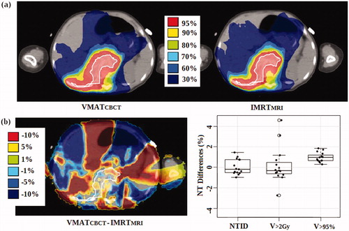 Figure 3. Dose comparison of a transversal planning-CT slice of one patient (a) and dose, NTID and NT volume differences (b) between the VMATCBCT and IMRTMRI workflows optimized with the PTVmean. The ITV is shaded in white (prescribed dose = 14.4 Gy).