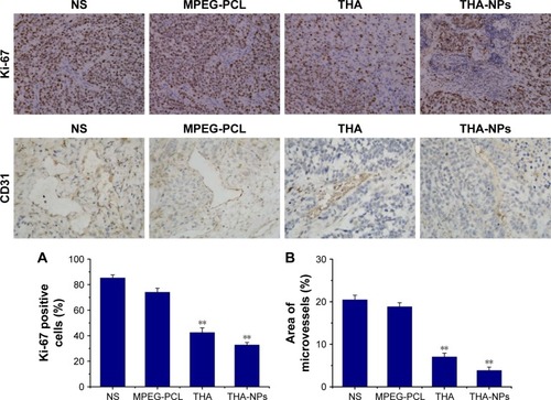 Figure 5 Ki-67 and CD31 immunohistochemical staining of tumors.Notes: (A, B) Quantitative analysis of Ki-67 and CD31 expression in xenografts from mice in various groups. **P<0.01. Original magnification, ×400.Abbreviations: MPEG-PCL, methoxy poly(ethylene glycol)-poly(ε-caprolactone); NS, normal saline; THA, thalidomide; THA-NPs, nanoparticles loaded with thalidomide.