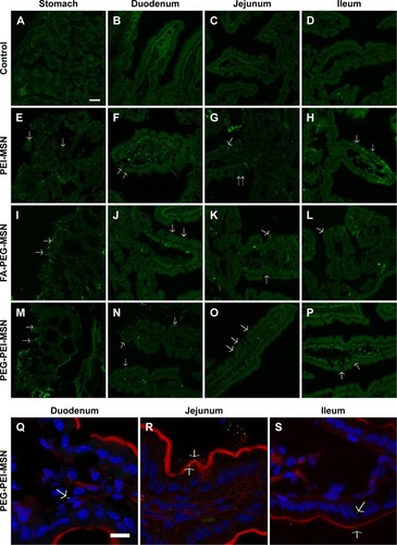 Figure 6 Functionalized MSNs are internalized to murine intestinal epithelia in vivo after oral administration.Notes: (A–P) MSNs were fed to mice by oral gavage, and intestinal tissues were excised, fixed in 4% paraformaldehyde, embedded in OCT compound, sectioned, and imaged. Confocal laser scanning microscopy images of the tissue sections are shown from stomach, duodenum, jejunum, and ileum of mice fed with PEI-MSNs, FA-PEG-MSNs, and PEG-PEI-MSNs in HEPES. Control mice were fed with HEPES alone. Arrows indicate internalized nanoparticles. Scale bar =25 μm. (Q–S) High-magnification confocal laser scanning microscopy show images of tissue sections from small intestine; duodenum, jejunum, and ileum of the mice fed with PEG-PEI-MSNs (green). Nuclei were stained with DAPI (blue) and F-actin with phalloidin (red) to indicate the brush border microvilli. Arrows indicate some of the nanoparticles particles taken up by the cells. Scale bar =10 μm.Abbreviations: MSN, mesoporous silica nanoparticle; OCT, optimum cutting temperature; PEI, poly(ethylene imine); FA, folic acid; PEG, poly(ethylene glycol); HEPES, 4-(2-hydroxyethyl)-1-piperazineethanesulfonic acid; DAPI, 4′,6-diamidino-2-phenylindole.