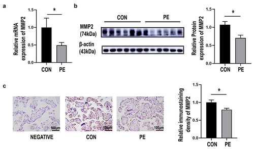 Figure 4. MMP2 was decreased in PE placentas. (a) The mRNA expression of MMP2 in placental tissues of preeclamptic patients (PE) and normal controls (CON) was determined using qRT-PCR. CON = 16, PE = 24. (b) Representative western blotting image of MMP2 in placental tissue samples and quantification of its expression normalized to β-actin in placentas. (CON: normal pregnancies, n = 6; PE: preeclamptic patients, n = 6). (c) Representative images from immunohistochemistry of MMP2 in human placentas with preeclampsia (PE) and without (CON). Original magnification: ×200; scale bar: 100 μm. Data are the mean ± SD from three independent experiments. Statistical significance was calculated by Student’s t test. *p < 0.05.