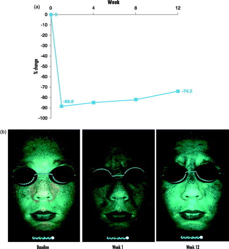Figure 6. Reduction in Propionibacterium acnes activity from week 1 onwards, as shown by (a) percentage change from baseline in the number of orange fluorescence pixels and (b) representative photographs of UV fluorescence image analysis.