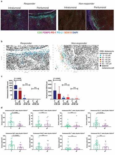 Figure 2. Spatial profiling of responders and non-responders treated with combination therapy. (a) Representative multiplex immunofluorescent images of intratumoral and peritumoral regions stained with CD8, FOXP3, PD-1, PD-L1, SOX10 and DAPI, from a responder and non-responder to combination anti-PD-1 and anti-CTLA-4 immunotherapy. (b) Scatter plots illustrating the number of CD8+ immune cells within proximity to a melanoma cell at 20 µM intervals, in a single representative image from a responding and non-responding patient. (c) Bar graphs showing the differences in the number of intratumoral and peritumoral CD8+ cells within proximity to a SOX10+ melanoma cell between responders and non-responders at 20 µM intervals. (d) Box plots comparing the number of immune cells within 20 µM of a SOX10+ tumor cell in responders and non-responders. Error bars represent SD