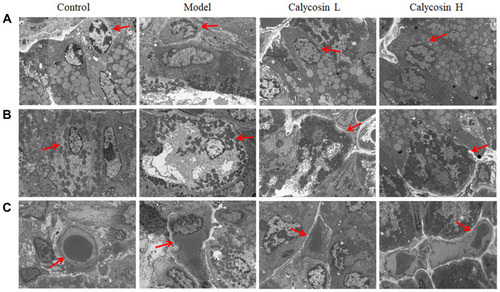 Figure 6 Effects of calycosin on ultrastructural changes in gastric mucosa of PLGC rats. (A) The ultrastructure of chief cells in gastric mucosa (2.5k×), and the red arrow represents chief cells. (B) The ultrastructure of parietal cells in the gastric mucosa (2.5k×), and the red arrow represents parietal cells. (C) The microvessel ultrastructure in gastric mucosa (2.5k×), and the red arrow represents microvessel.