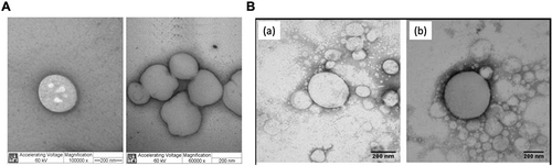 Figure 3 Morphology of different types of lipid nanoparticles for local anesthetic delivery. (A) TEM micrographs of the SLN formulations SLNCPDBC, prepared by high-pressure homogenization, at two different magnifications: 100,000x (left) and 60,000x (right). Scale bar, 200 nm. Reproduced from de M Barbosa R, Ribeiro LNM, Casadei BR, et al. Solid lipid nanoparticles for dibucaine sustained release. Pharmaceutics. 2018;10(4):231. Creative Commons.Citation30 Licensee MDPI, Basel, Switzerland. (B) TEM images of optimised NLC formulation without (a) and with bupivacaine (b). Magnification, 60,000x. Scale bar, 200 nm. Reprinted from Int J Pharm, 529(1-2), Rodrigues da Silva GH, Ribeiro LNM, Mitsutake H, et al. Optimised NLC: a nanotechnological approach to improve the anaesthetic effect of bupivacaine. 253–263, Copyright 2017, with permission from Elsevier.Citation35
