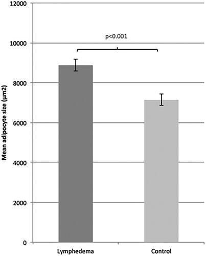 Figure 2. Mean adipocyte size (mean ± SEM) between lymphedema and control in all patients.