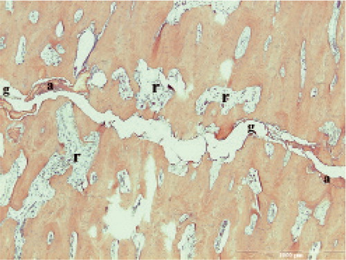 Figure 8. Incomplete fracture. g fracture gap, a amorphous material, r resorption cavity.