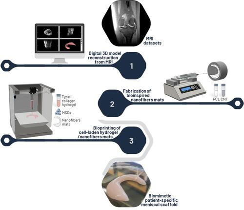 Figure 1 Overview of biofabrication strategy to create a novel patient-specific meniscal scaffold based on bioprinting of cell-laden type 1 collagen hydrogel reinforced by multilayers of biomimetically aligned electrospun PCL/CNT nanofibers.