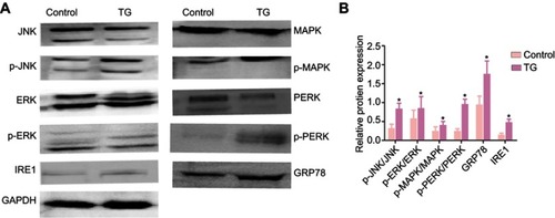 Figure 8 Expression of the JNK signaling-related proteins JNK, p-JNK, ERK, p-ERK, MAPK, p-MAPK, PERK, p-PERK, IRE1 and GRP78 in tumers in nude mice that treated with or without TG were analyzed by WB (A and B). The data is represented as means ± SD (n=5). *p<0.05 vs the control group.