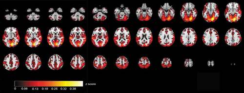 Figure 2. Correlating activation areas in the control group (p< .001, FDR corrected)