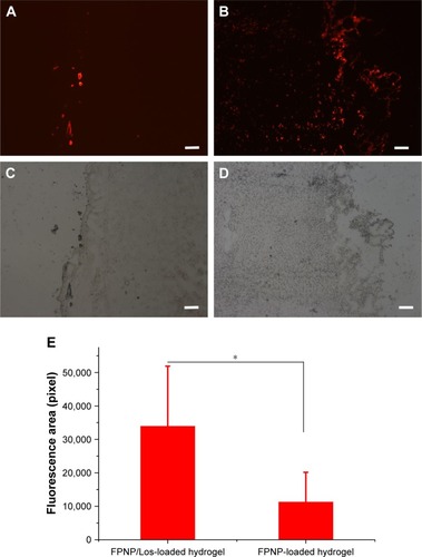 Figure 5 Fluorescent images of intratumoral distribution after peritumoral implantation of (A) FPNP-loaded hydrogel and (B) FPNP/Los-loaded hydrogel for 2 weeks. (C) Bright-field image of (A). (D) Bright-field image of (B). (E) Quantitative analysis of nanoparticle distribution with ImageJ (n=9, mean ± SD).Notes: Scale bar represents 100 µm; magnification 100×. *P<0.05.Abbreviations: FPNPs, fluorescent polystyrene nanoparticles; Los, losartan.