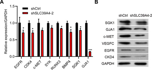 Figure 7 Downregulation of SLC39A4 expression influenced the malignant-development potential of GBC-SD cells. (A) mRNA expression of target genes in GBC-SD/shSLC39A4-2 cells by real-time RT-qPCR. Results are representative of three independent experiments, and are shown as the mean ± SD (unpaired t-test). *p < 0.05, ***p < 0.001, compared with GBC-SD/shCtrl. (B) Protein expression of indicated target genes in GBC-SD/shSLC39A4-2 cells by Western blotting.