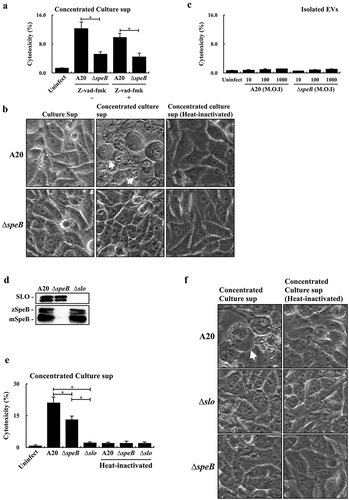 Figure 4. Extracellular vesicle-associated SpeB fails to trigger HaCaT keratinocyte pyroptosis. (a) The cytotoxicity of the concentrated supernatant (by 10 kDa centrifugal filter) from A20 and the speB mutant (∆speB) to HaCaT cells. HaCaT cells were incubated with the 2-fold concentrated supernatants at 37ºC for 4 h. Z-vad-fmk (20 µM), the pan-caspase inhibitor. The morphology of concentrated supernatant-treated cells was shown in (b). The bubbling morphology, the typical characteristic of pyroptotic cells, is indicated by arrows. (c) Cytotoxicity of EVs from A20 and the speB mutant to HaCaT cells. HaCaT cells were treated by EVs with the multiplicity of infection (M.O.I.) 10–1000 at 37ºC for 4 h. (d) The expression of SpeB and SLO in A20, the speB mutant, and the slo mutant (∆slo). Bacterial strains were cultured to the stationary phase and the bacterial culture supernatant was analysed by western blot hybridization. zSpeB, the zymogen form SpeB (42 kDa); mSpeB, the mature form SpeB (28 kDa). (e) The cytotoxicity of the concentrated supernatant (by 10 kDa centrifugal filter) from A20, the speB mutant, and the slo mutant to HaCaT cells. The morphology of concentrated supernatant-treated cells was shown in (f) and the bubbling cell morphology was indicated by the arrow. Cytotoxicity was determined by the lactate dehydrogenase (LDH) assay. *, P < 0.05.