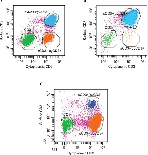 Figure 1 Characteristic flow cytometry of intraepithelial lymphocytes isolated from intestinal biopsies incubated with anti-CD3 antibodies prior to and after permeabilization in order to identify cell sCD3 (y axis) and cyCD3 (x axis) expression.