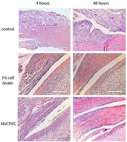 Figure 7 Photomicrographs of H&E stains of the anterior discal attachments and synovial lining of the control specimens compared to the 1% cell lysate and the HUCPVC-treated specimens at the 4-hour and 48-hour timepoints. The white arrow in the top left photomicrograph demonstrates a region of capillaries that were dispersed throughout the underlying loose connective tissue below the synovial lining in the 4-hour control. The 48-hour control specimen demonstrates increased cell density (white arrow) in the synovial lining and the formation of villous-like projections secondary to infolding of the synovial lining that was not observed in the lysate and HUCPVC-treated specimens. Scale bar = 200 µm for 1% cell lysate and HUCPVC-treated groups, 100 µm for control.
