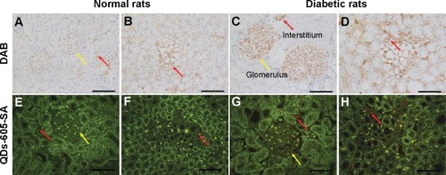 Figure 6 The expression of aldose reductase (AR) stained by 3,3′-diaminobenzidine (DAB) and quantum dots with the emission wavelength of 605 nm conjugated to streptavidin (QDs-605-SA) in rat renal tissues. (A, B, E, and F) Normal rat tissue; (C, D, G, and H) diabetic rat tissue. The green background in (E–H) is tissue autofluorescence and the red signal is quantum-dot fluorescent. The expression of AR is located in the glomerulus (yellow arrows) and renal interstitium (red arrows) of rats.Note: Scale bars: 100 μm.